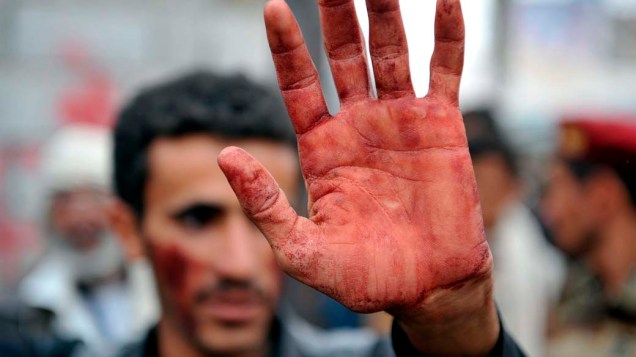 Manifestante mostra mão suja de sangue após carregar companheiro ferido durante confronto entre opositores e defensores do governo do presidente Ali Abdullah Saleh em Sanaa, Iêmen