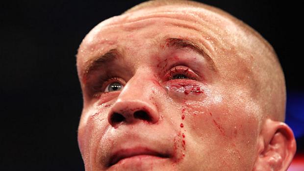 O canadense Mack Hominick, após perder para o brasileiro José Aldo, no UFC 129