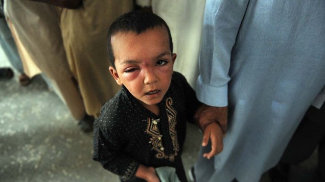 Criança espera por atendimento médico em Nowshera, no Paquistão. A ONU estima que cerca de 800 mil pessoas necessitem de assistência no país