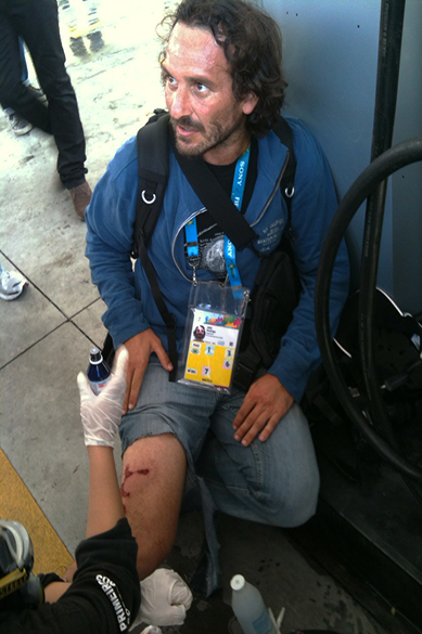 Fotógrafo argentino Rodrigo ABD, da agência AP, foi ferido por estilhaços de bomba na rua Platina
