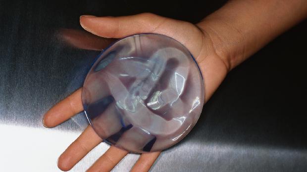 Alíquota de importação do gel de polidimetilsiloxano para uso em próteses de silicone passou de 14% para 2%