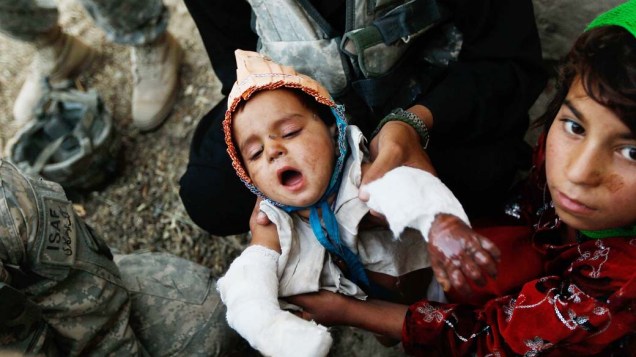 Soldados americanos socorrem criança que sofreu acidente doméstico em Kandahar, no Afeganistão