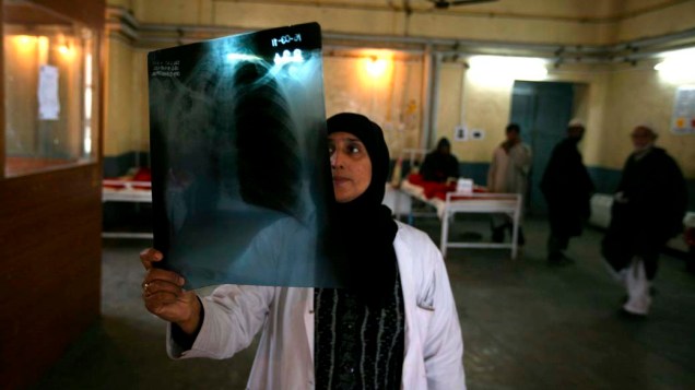 No Dia Mundial da Luta contra a Tuberculose, médica examina radiografia pulmonar em hospital na cidade de Caxemira, Índia