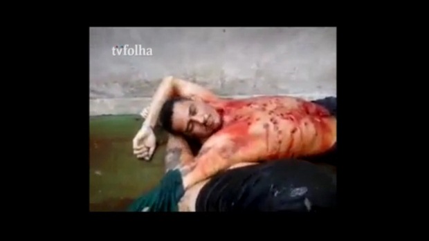 Detendo ferido dentro de presídio em Pedrinhas, no Maranhão Detendo ferido dentro de presídio em Pedrinhas, no Maranhão