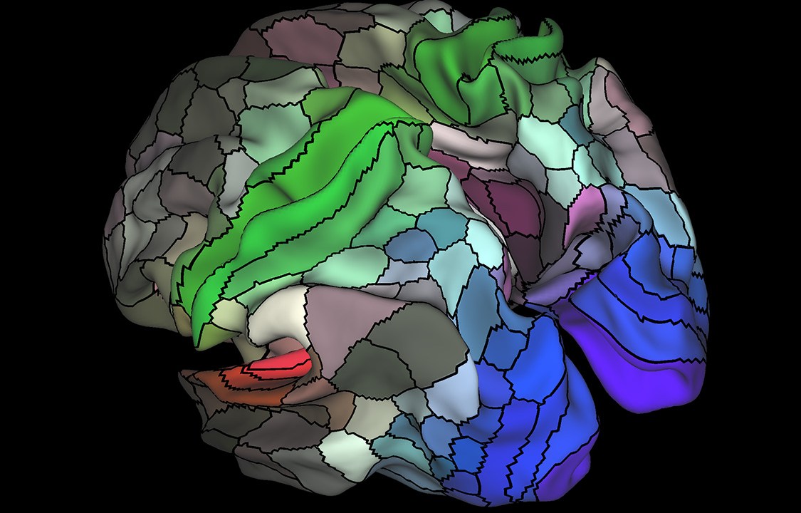 A imagem mostra as 180 áreas do cérebro nos hemisférios direito e esquerdo.
