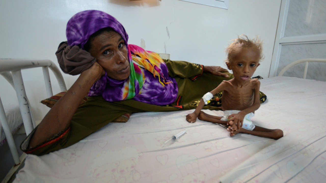 Mulher descansa em uma cama com seu filho desnutrido em hospital da cidade portuária de Houdieda, no Iêmen - 09/09/2016