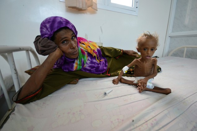 Mulher descansa em uma cama com seu filho desnutrido em hospital da cidade portuária de Houdieda, no Iêmen - 09/09/2016