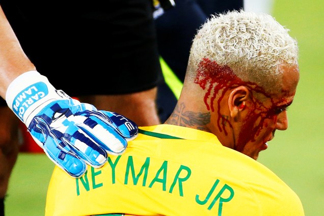 O jogador Neymar é visto sangrando após receber cotovelada durante partida contra a Bolívia, realizada na Arena das Dunas, em Natal (RN), válida pelas eliminatórias sul-americanas para a Copa do Mundo de 2018
