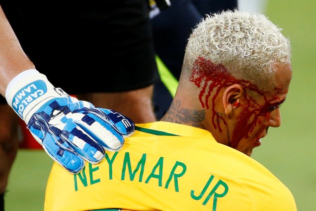 Neymar sofre corte na cabeça durante jogo contra a Bolívia na Arena das Dunas, em Natal