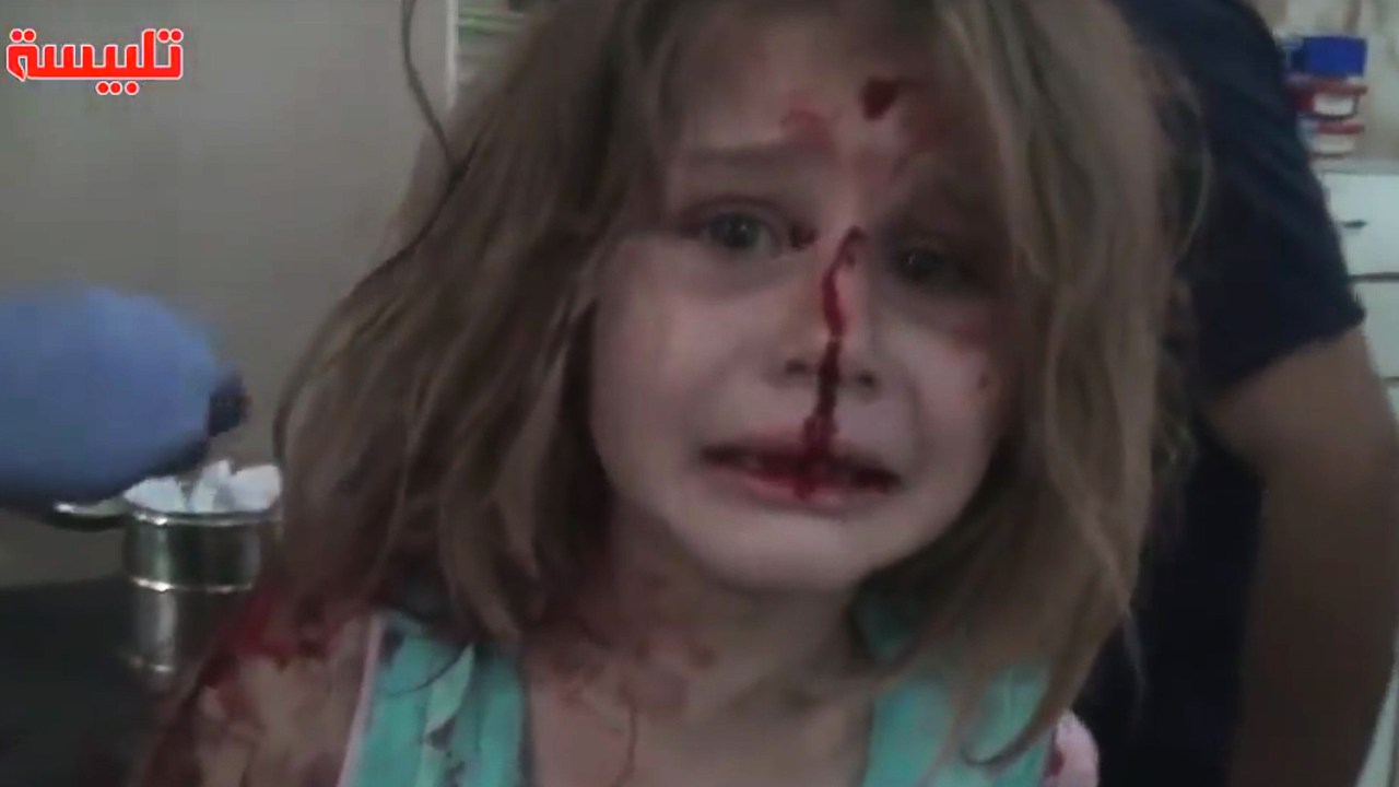 Menina síria ferida procura pelo pai
