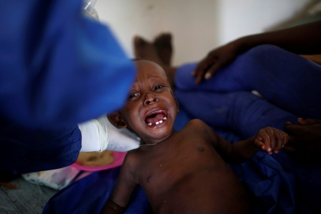 Criança recebe tratamento em um hospital após a passagem do furacão Matthew em Jeremie, no Haiti - 09/10/2016
