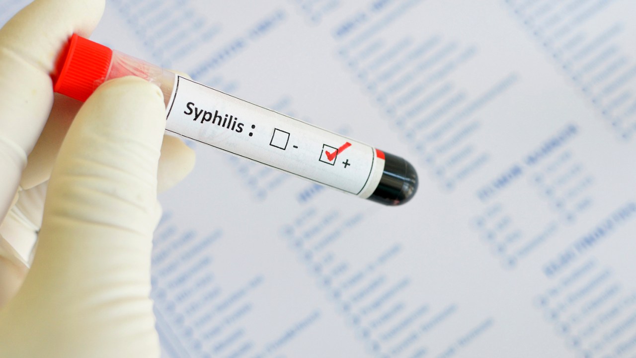 Saúde - Sífilis