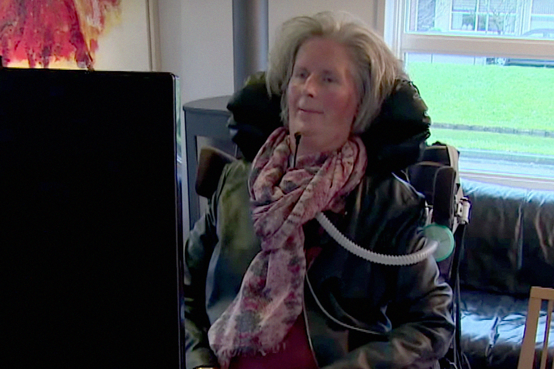 Hanneke de Brujine, paciente com transplante cerebral
