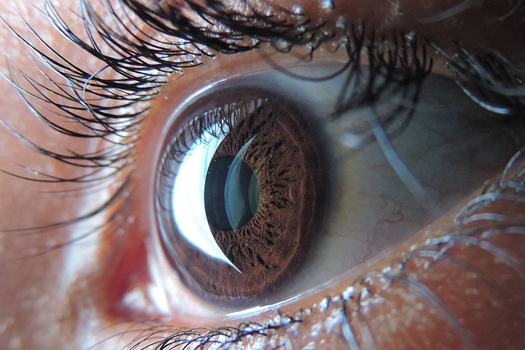 Eye close up