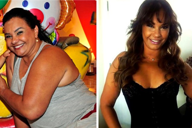 A atriz Solange Couto fez a cirurgia de redução de estômago em 2013. Desde então, perdeu cerca de 50 quilos