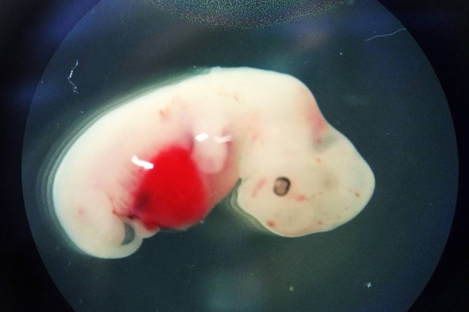 <p style="text-align:justify;">Cientistas americanos desenvolveram embriões que contêm uma combinação de células-tronco de humanos e porcos. O experimento, realizado em janeiro, foi uma tentativa de encontrar alternativas para transplantes de órgãos em humanos. “Este é um primeiro passo importante. O objetivo final é desenvolver tecidos e órgãos funcionais e transplantáveis, mas estamos longe disso”, afirmou o autor principal, Juan Carlos Izpisua Belmonte, professor do laboratório de expressão genética do Instituto Salk para Pesquisas Biológicas, nos Estados Unidos.</p><p style="text-align:justify;">Porém, a ideia de criar uma mistura entre humanos e animais levantou questões éticas, principalmente porque, na teoria, isso poderia levar à criação de animais com qualidades humanas e, possivelmente, inteligência. Ainda assim, os cientistas defendem o experimento afirmando que o nível de contribuição humana para os embriões de porcos foi “baixo” e não incluiu precursores de células cerebrais. Além disso, os embriões se desenvolveram apenas por quatro semanas.</p> <p style="text-align:justify;">Cientistas americanos desenvolveram embriões que contêm uma combinação de células-tronco de humanos e porcos. O experimento, realizado em janeiro, foi uma tentativa de encontrar alternativas para transplantes de órgãos em humanos. “Este é um primeiro passo importante. O objetivo final é desenvolver tecidos e órgãos funcionais e transplantáveis, mas estamos longe disso”, afirmou o autor principal, Juan Carlos Izpisua Belmonte, professor do laboratório de expressão genética do Instituto Salk para Pesquisas Biológicas, nos Estados Unidos.</p><p style="text-align:justify;">Porém, a ideia de criar uma mistura entre humanos e animais levantou questões éticas, principalmente porque, na teoria, isso poderia levar à criação de animais com qualidades humanas e, possivelmente, inteligência. Ainda assim, os cientistas defendem o experimento afirmando que o nível de contribuição humana para os embriões de porcos foi “baixo” e não incluiu precursores de células cerebrais. Além disso, os embriões se desenvolveram apenas por quatro semanas.</p>