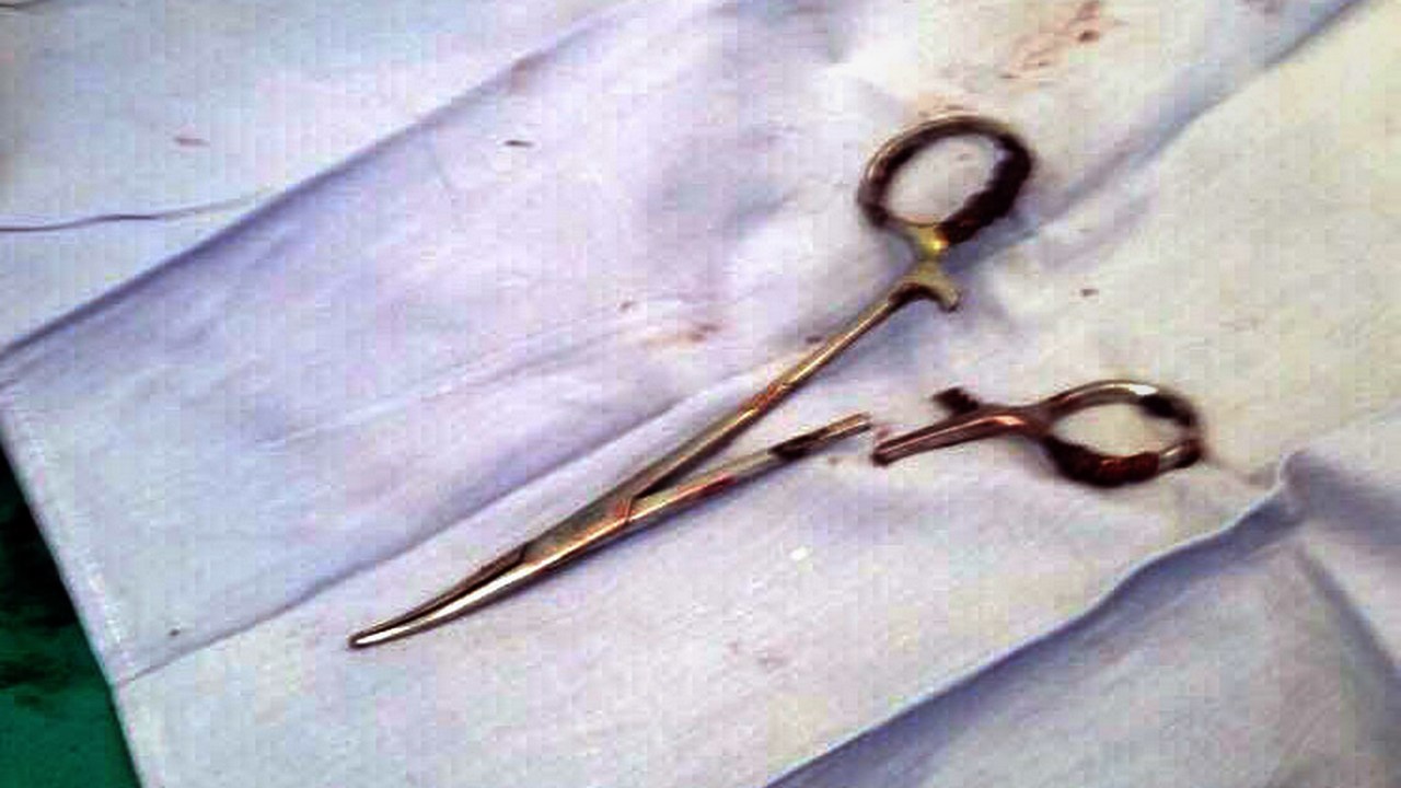 Médicos removem tesoura do corpo de um paciente no Vietnã