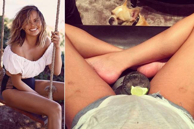 Modelo Chrissy Teigen publica foto de suas estrias no Instagram Modelo Chrissy Teigen publica foto de suas estrias no Instagram