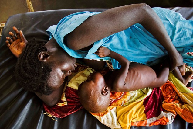 Mãe alimenta seu filho que sofre de subnutrição, no Sudão do Sul