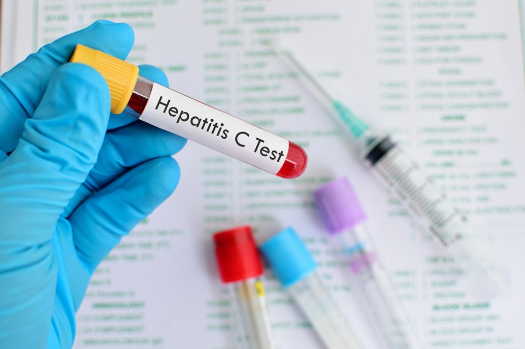Teste de Hepatite C