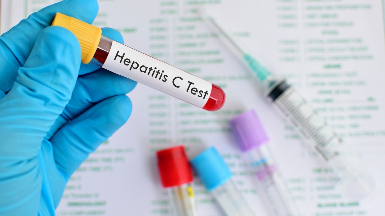 Teste de Hepatite C