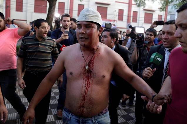 Manifestante é ferido durante protesto contra aprovação da reeleição presidencial no Paraguai - 31/03/2017
