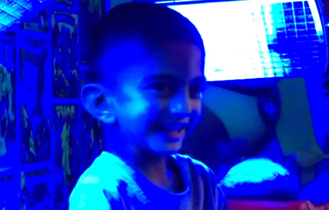 Ismail Ali, garoto de 4 anos, com doença rara