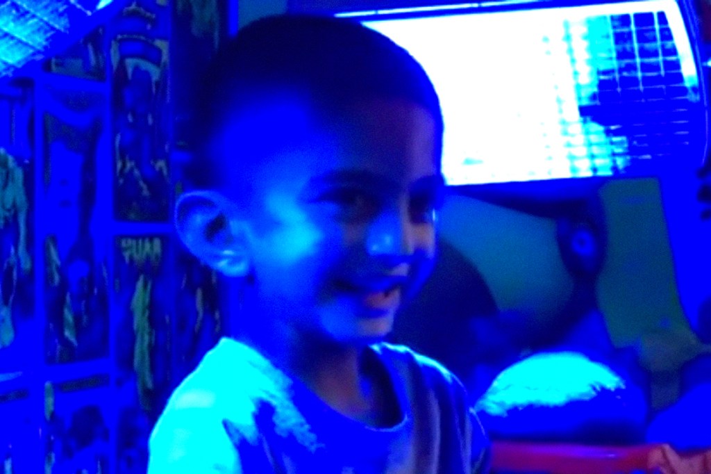 Ismail Ali, garoto de 4 anos, com doença rara