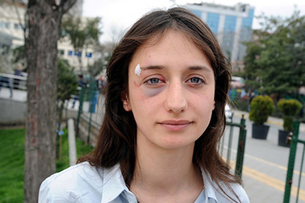Jovem agredida na Turquia