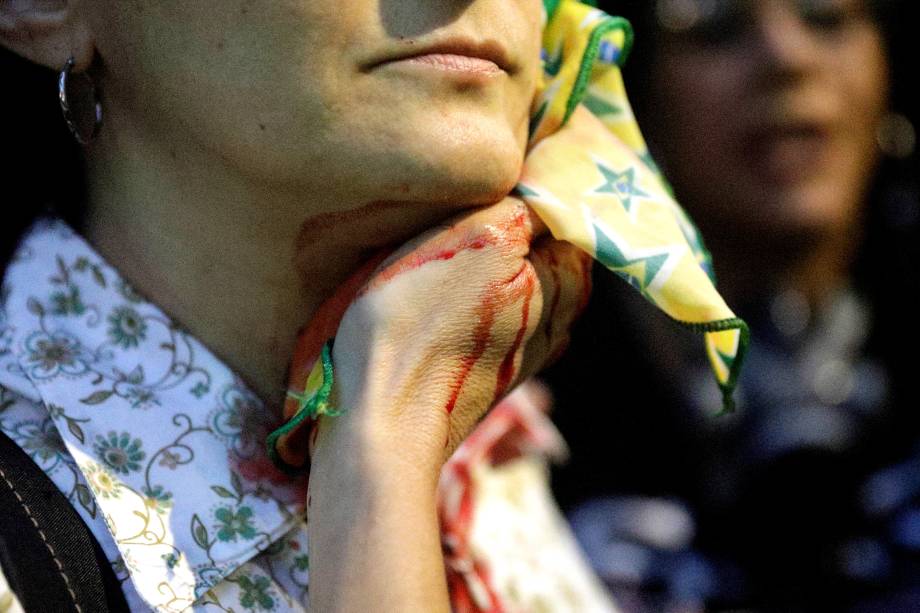 Manifestante ferida por bala de borracha durante protestos no Rio de Janeiro contra as reformas da previdência e trabalhista do governo Michel Temer - 28/04/2017