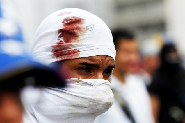 Manifestante ferido durante protesto contra o governo de Nicolás Maduro em Caracas, Venezuela - 06/04/2017