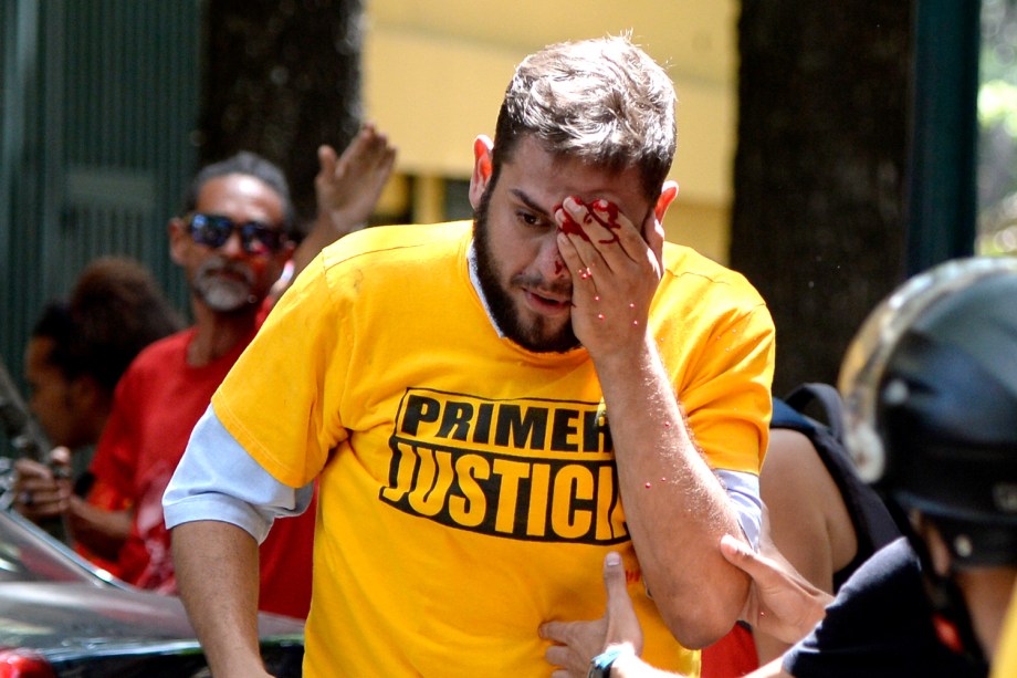 O deputado Juan Requesens, atingido por um cassetete, durante o protesto desta segunda (3) contra o governo de Nicolás Maduro em Caracas, Venezuela - 03/04/2017