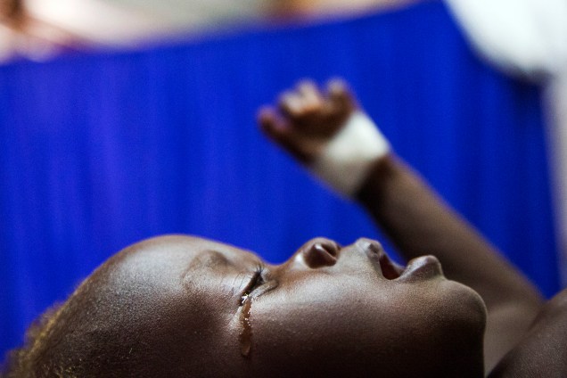 O pequeno Achol Ri, de um ano e meio recebe tratamento contra uma grave desnutrição em uma clínica administrada pela organização humanitária Médicos Sem Fronteiras (MSF) em Aweil, Northern Bahr al Ghazal, no Sudão do Sul - 30/05/2017