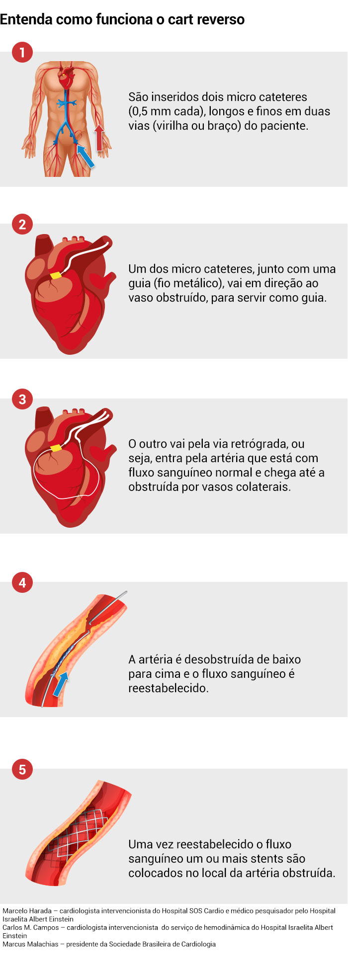 Entenda como funciona o cart reverso