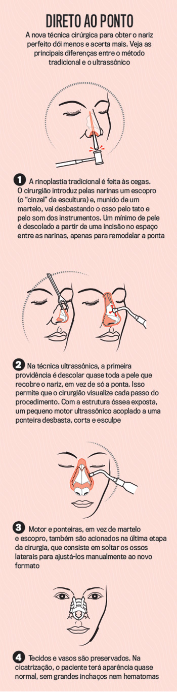 ilustracao-cirurgia-nariz-perfeito