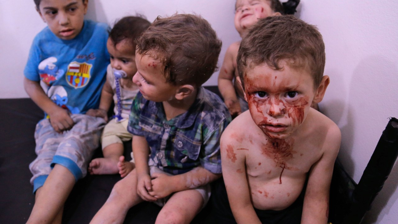 Imagens do dia - Crianças feridas na Síria