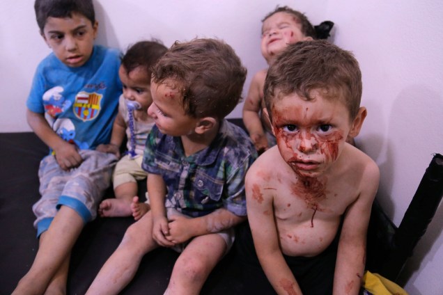 Crianças sírias esperam para receber tratamento em um hospital depois de um bombardeio na cidade rebelde de Arbin, a leste da capital Damasco - 24/07/2017
