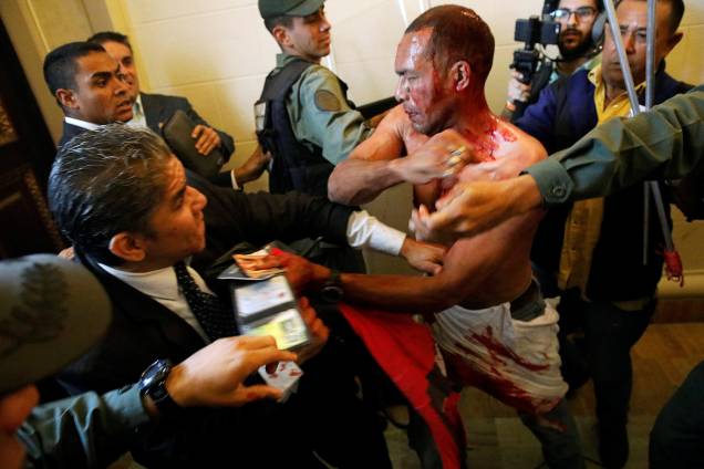 Homem coberto de sangue tenta deixar a Assembleia Nacional da Venezuela, após um grupo de apoiadores do governo de Nicolas Maduro invadiram a sede do Legislativo, controlada pela oposição, em protesto durante uma sessão parlamentar - 05/07/2017