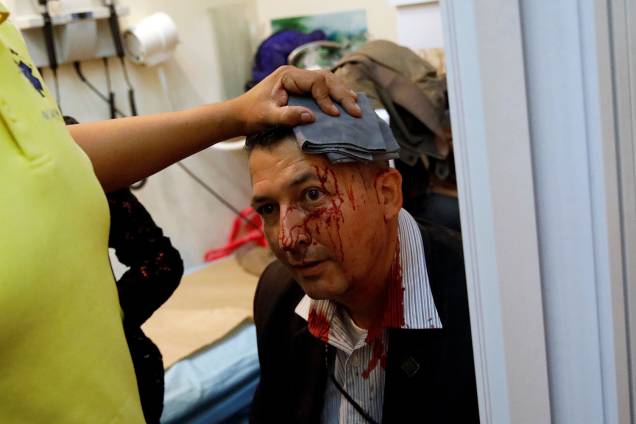 Homem coberto de sangue tenta deixar a Assembleia Nacional da Venezuela, após um grupo de apoiadores do governo de Nicolas Maduro invadiram a sede do Legislativo, controlada pela oposição, em protesto durante uma sessão parlamentar - 05/07/2017
