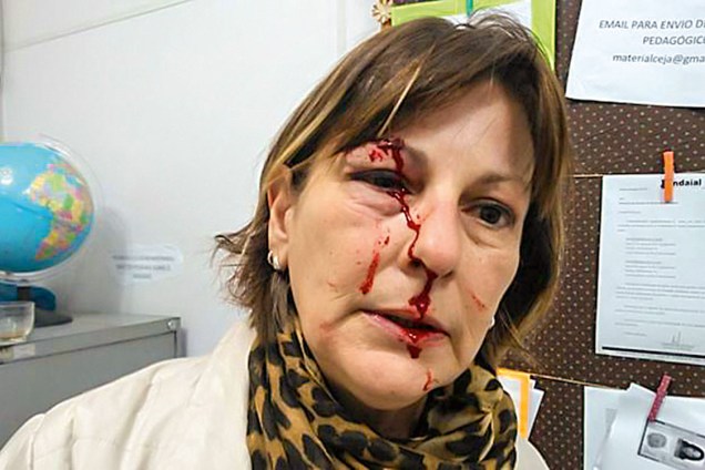 Soco na cara - A foto postada pela professora Marcia: atacada por um aluno adolescente no dia da volta às aulas