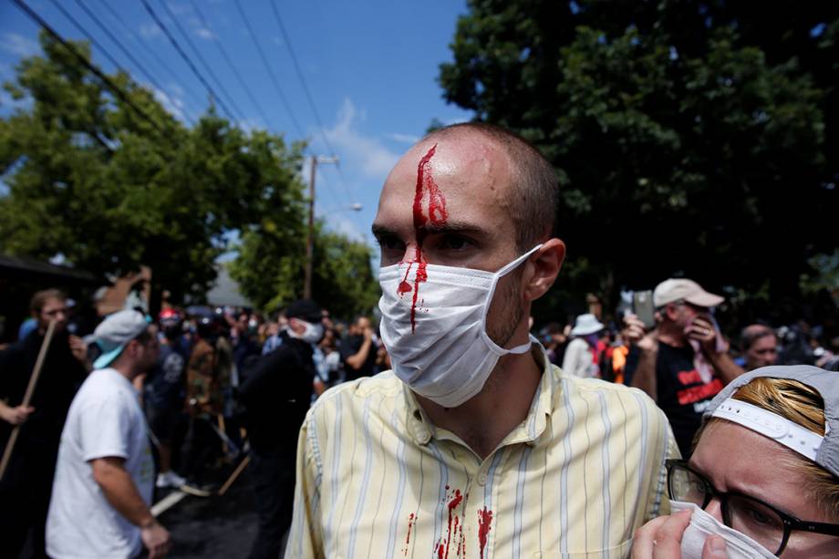 Homem ferido após confronto contra supremacistas brancos, em Charlottesville, Virginia