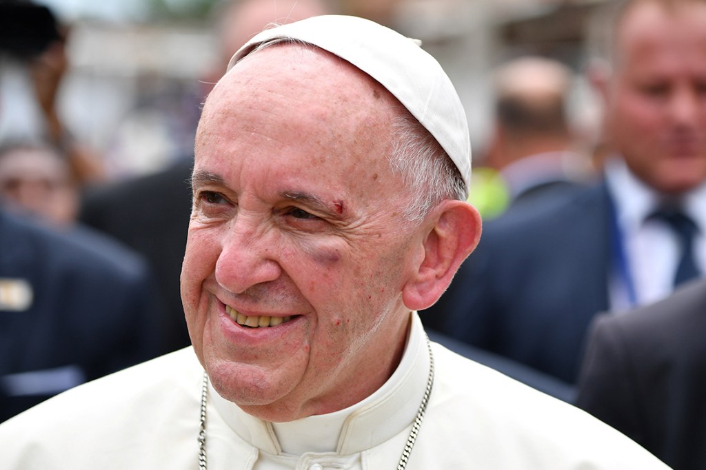 Papa Francisco sofre ferimento na Colômbia