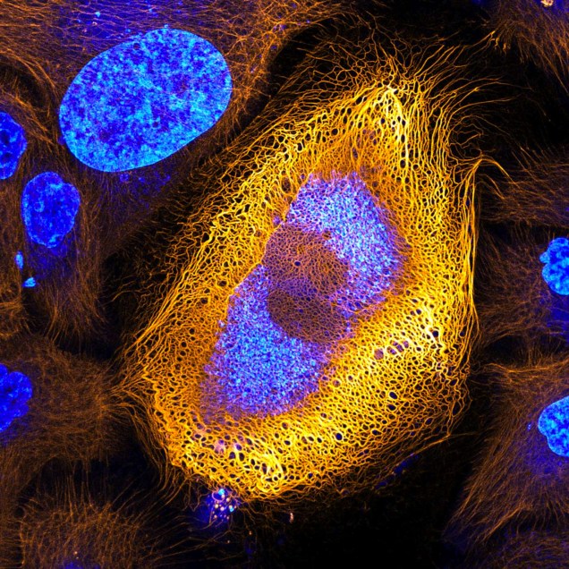 Para abrir a lista, Dr. Bram van den Broek registrou a incrível imagem microscópica de uma célula da pele humana imortalizada