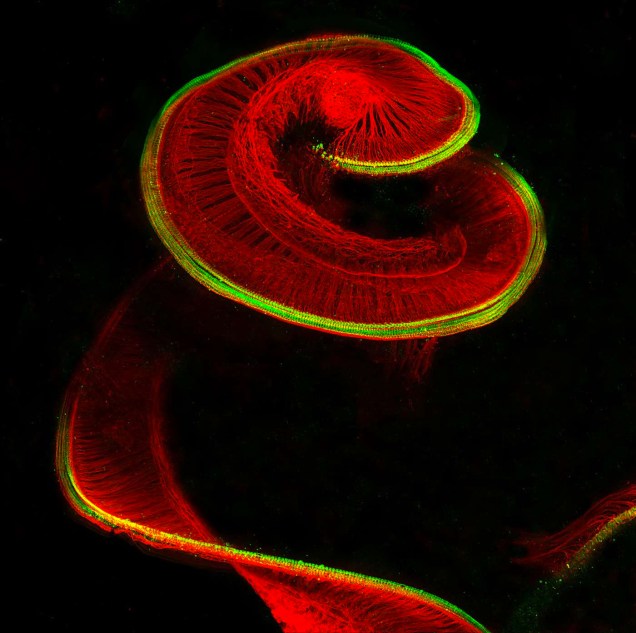 No oitavo lugar Dr. Michael Perny ampliou 100x o interior do ouvido de um rato recém nascido e registrou células ciliadas sensoriais (verde) e neurônios ganglionares espirais (vermelho)