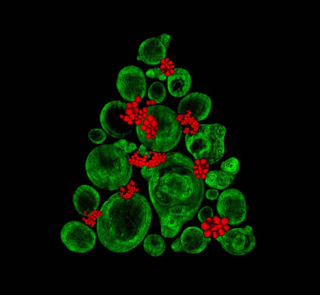 Catarina Moura cultivou em laboratório um pedaço de tecido semelhante à cartilagem usando células-tronco ósseas e a ampliação parecida com uma árvore de natal lhe rendeu o 9º lugar Catarina Moura cultivou em laboratório um pedaço de tecido semelhante à cartilagem usando células-tronco ósseas e a ampliação parecida com uma árvore de natal lhe rendeu o 9º lugar
