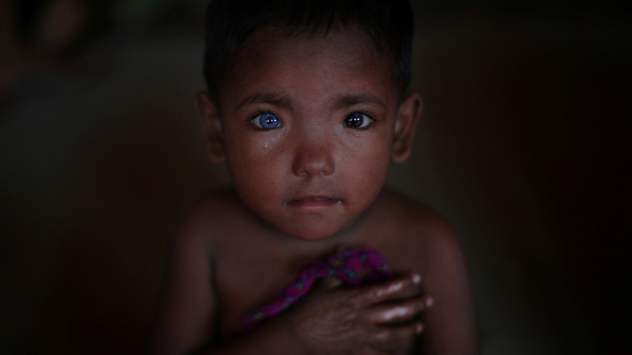 Imagens do dia - Refugiado rohingya