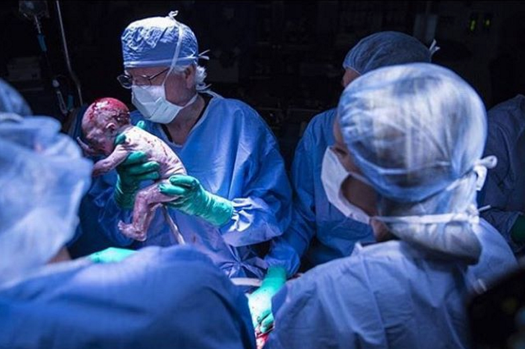 Mãe que se submeteu a transplante de útero dá à luz em hospital universitário em Dallas, no Texas