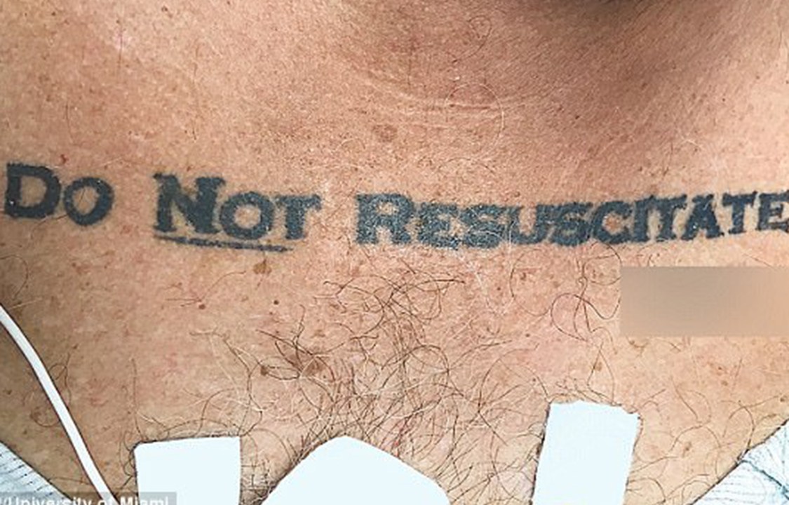 Paciente inconsciente chega em hospital de Miami com tatuagem de "Não ressucitar" e sua própria assinatura logo abaixo