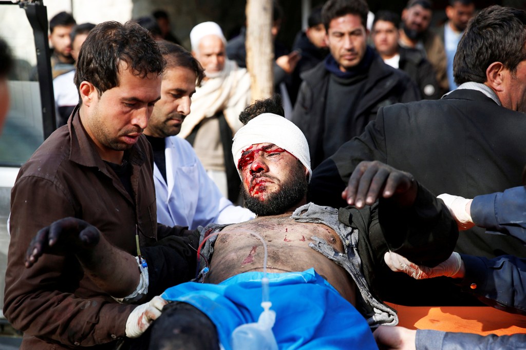 Ferido recebe assistência médica após explosão em hospital de Cabul
