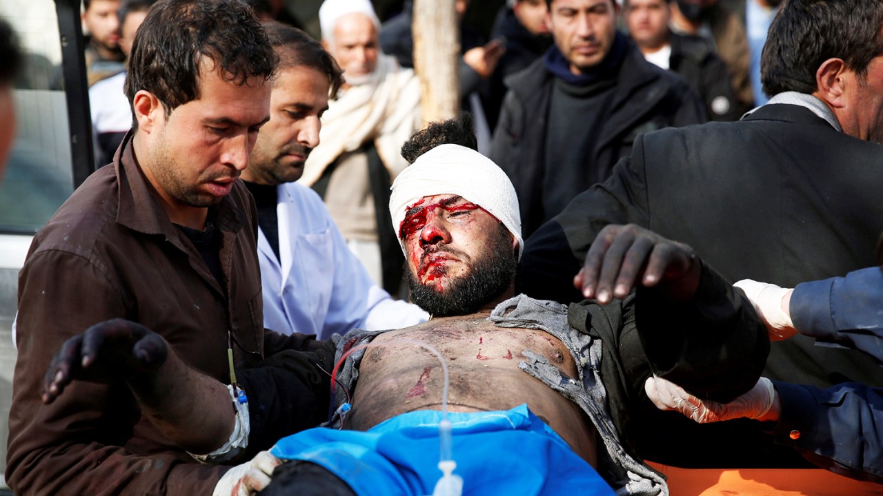 Ferido recebe assistência médica após explosão em hospital de Cabul